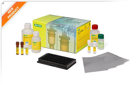 Bio-Plex Multiplex SARS-CoV-2 Serology Assay Kits and Reagents | Bio-Rad Laboratories