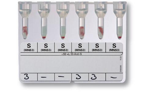 ID-Card S | Bio-Rad Laboratories