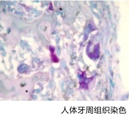 抗酒石酸酸性磷酸酶染液,Tartrate-resistt acid phosphatase Stain Kit