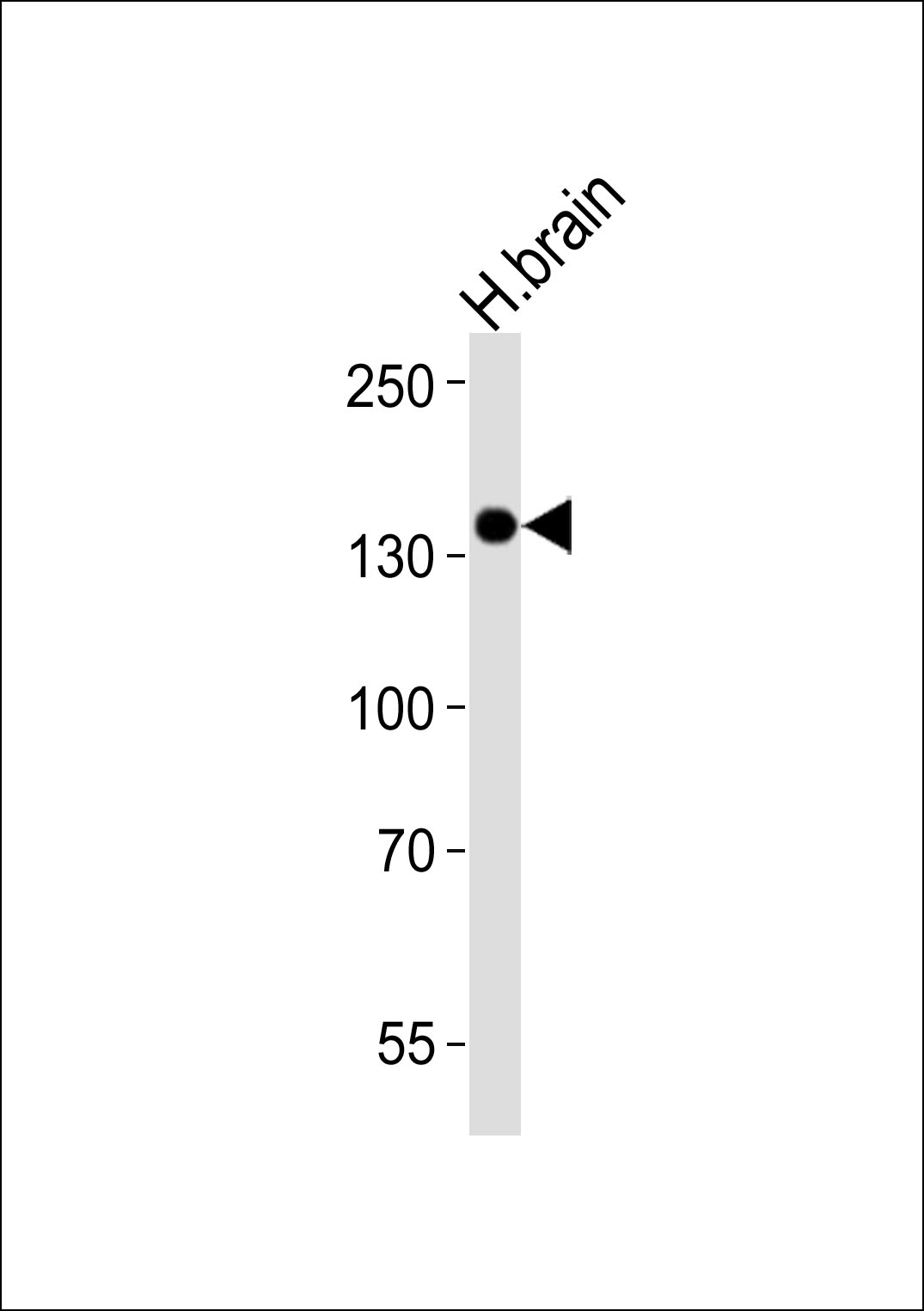 Mouse anti-Ntrk3 Monoclonal Antibody(1454CT394.87.35)