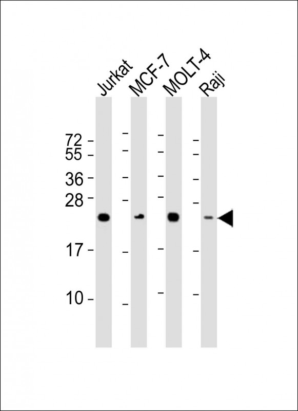 Mouse anti-MGMT Monoclonal Antibody(1527CT158.87.44)
