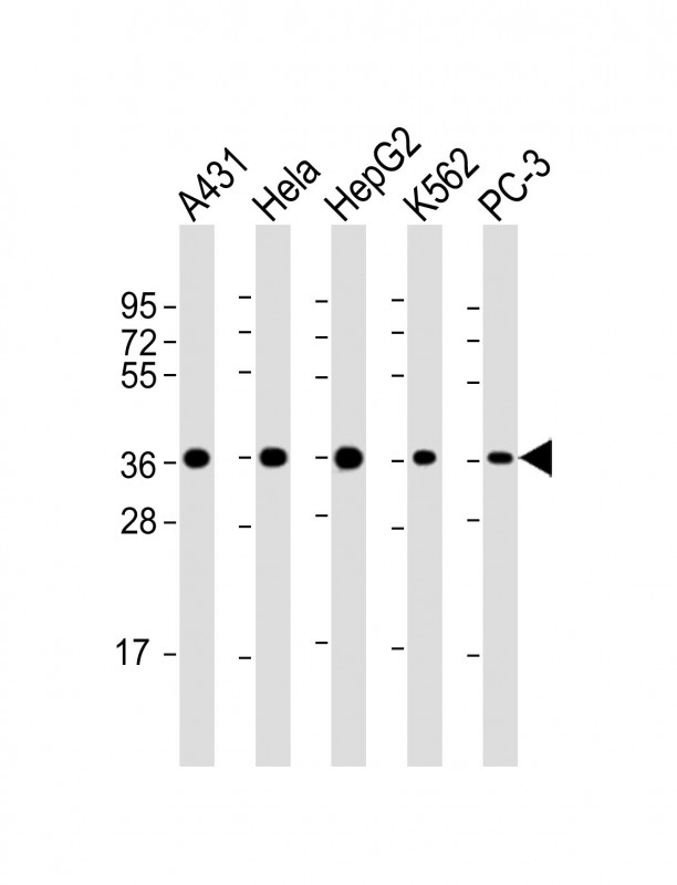 Mouse anti-APEX1 Monoclonal Antibody(1518CT337.123.86.269.232)