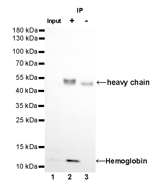 Rabbit anti-Hemoglobin Recombinant Monoclonal Antibody(193-71)