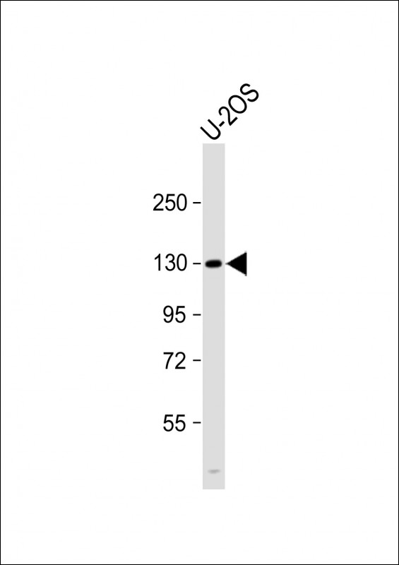 Rabbit anti-DNMT3A Polyclonal Antibody(Center R478)