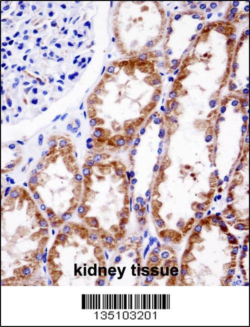 Rabbit anti-DNMT3A Polyclonal Antibody(Center R478)