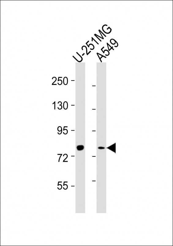 Mouse anti-FES Monoclonal Antibody(1467CT528.22.17)