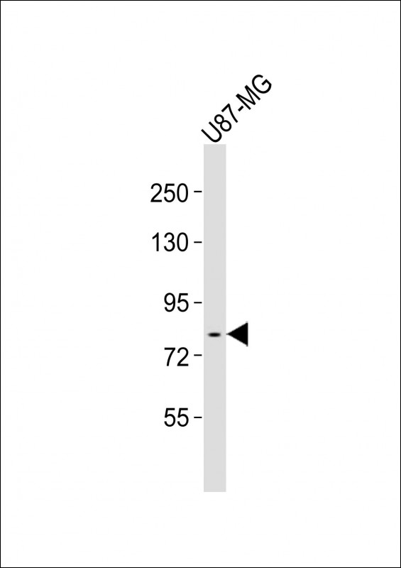 Mouse anti-FES Monoclonal Antibody(1467CT528.22.17)