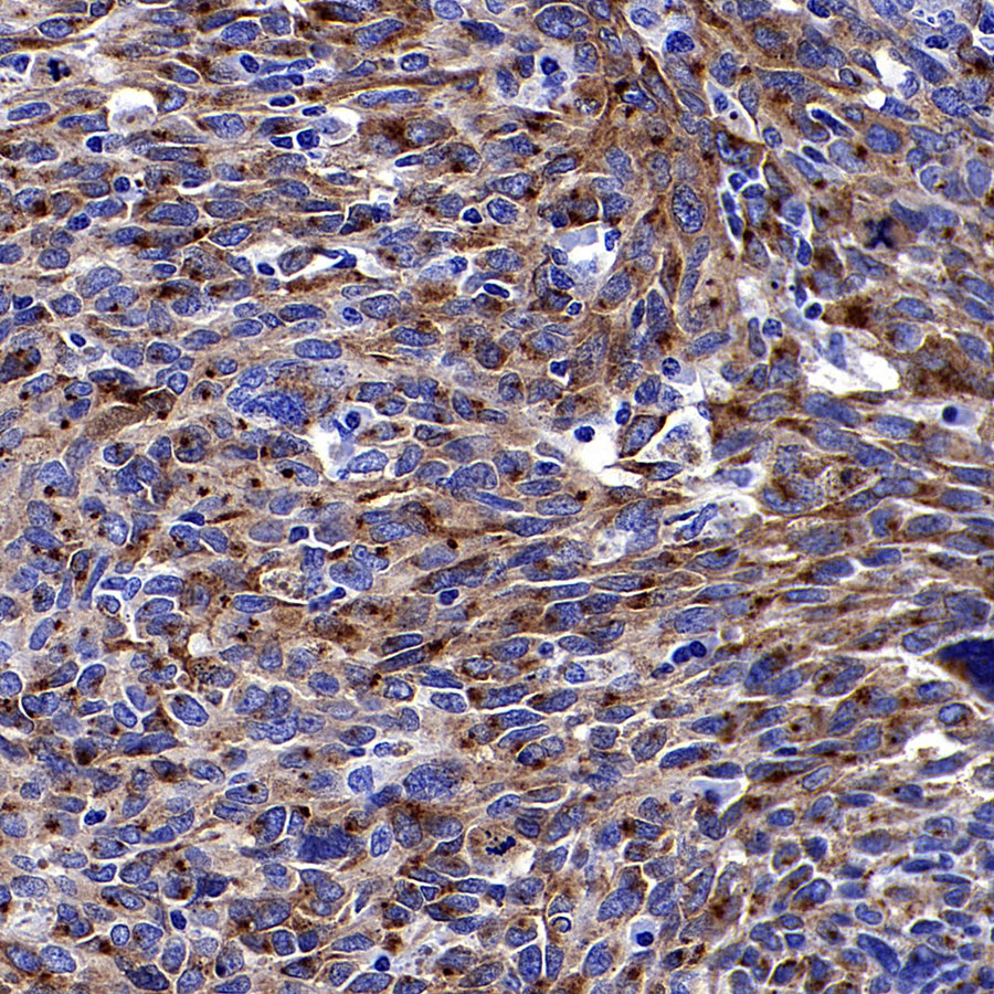 Rabbit anti-PMEL/Melanoma gp100 Recombinant Monoclonal Antibody(434-70)
