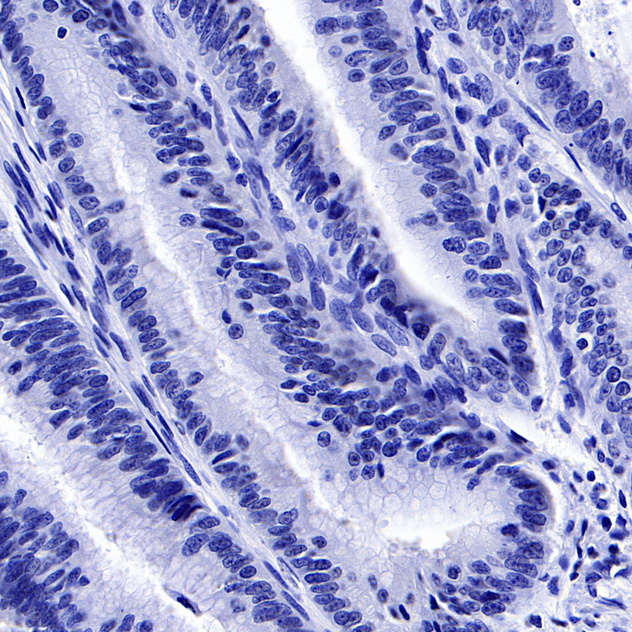 Rabbit anti-PMEL/Melanoma gp100 Recombinant Monoclonal Antibody(434-70)