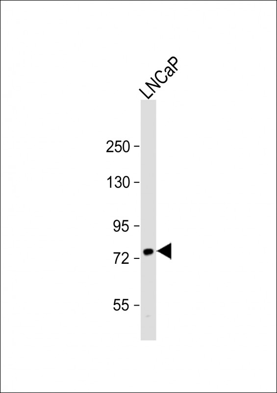 Rabbit anti-PFKL Polyclonal Antibody(Center K433)