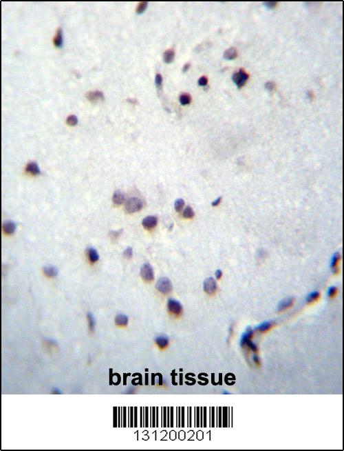 Rabbit anti-ZNF417 Polyclonal Antibody(Center)