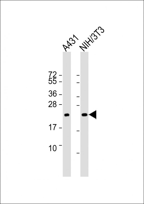 Mouse anti-RRAS2 Monoclonal Antibody(1578CT130.349.47.14)