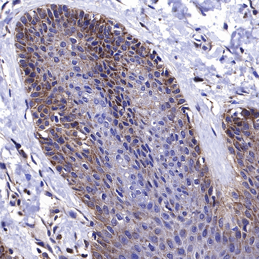 Rabbit anti-BAX Recombinant Monoclonal Antibody(338-76)