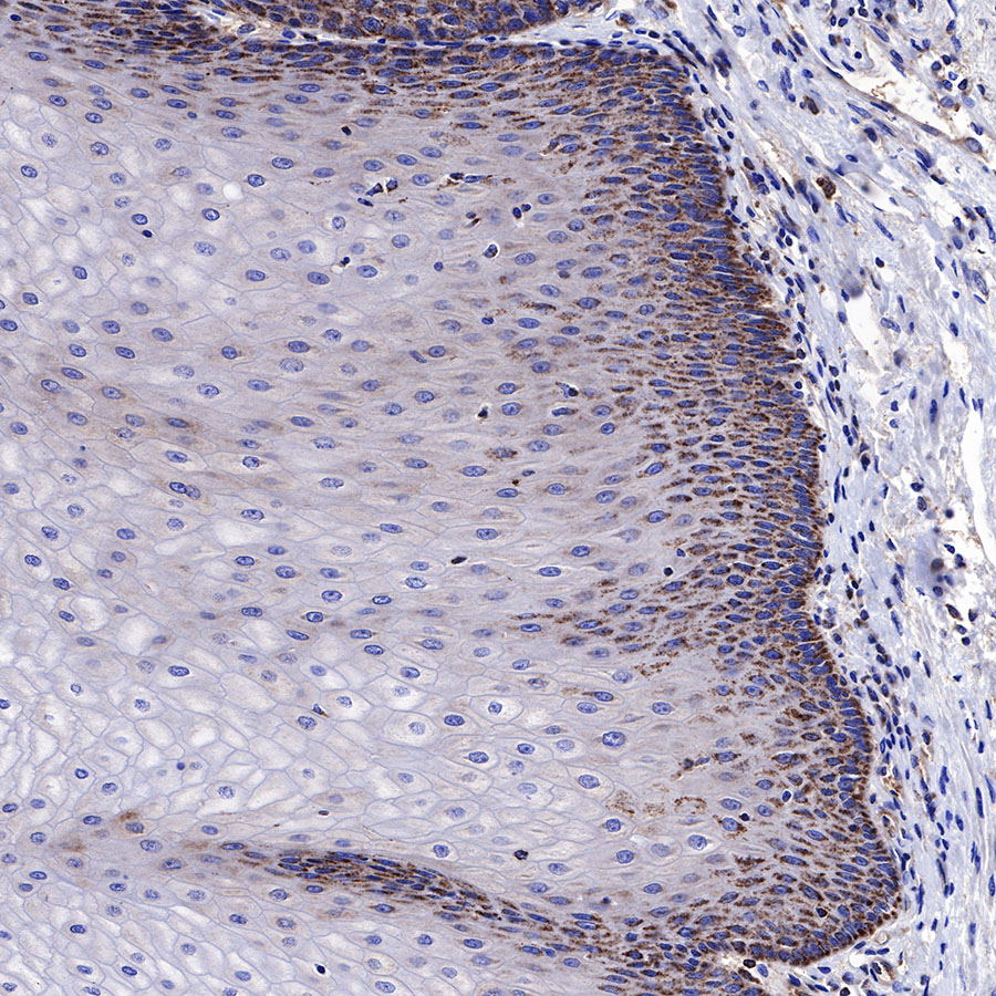 Rabbit anti-BAX Recombinant Monoclonal Antibody(338-76)