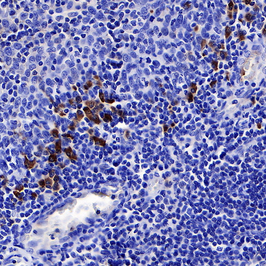 Rabbit anti-Human IgG  F(c) Recombinant Monoclonal Antibody(318-21)