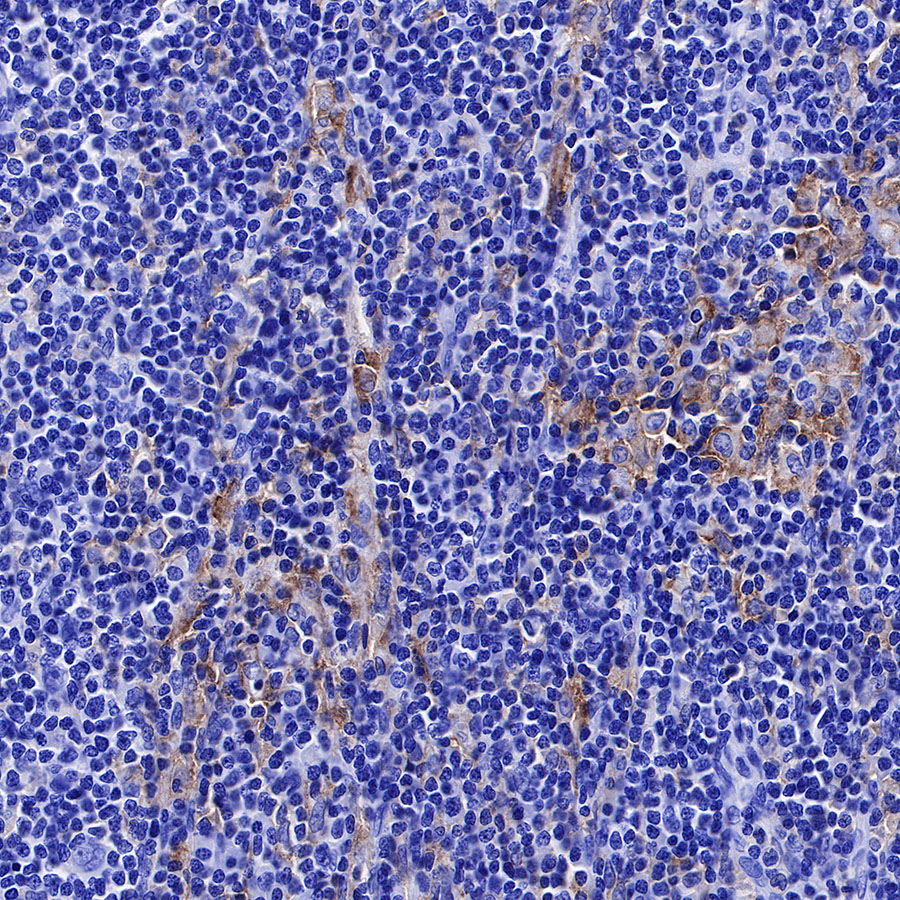 Rabbit anti-CD33 Recombinant Monoclonal Antibody(269-171)