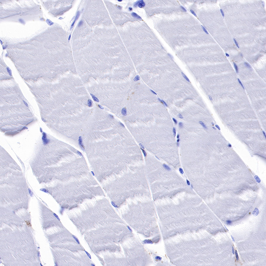 Rabbit anti-CD33 Recombinant Monoclonal Antibody(269-171)