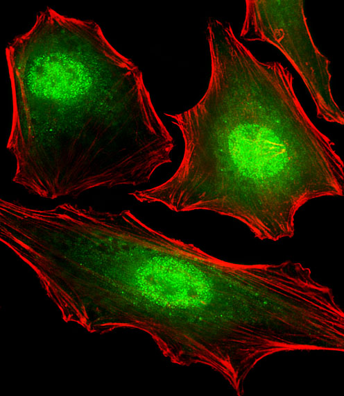 Mouse anti-FUBP3 Monoclonal Antibody(N-term)(1216CT820.155.150)