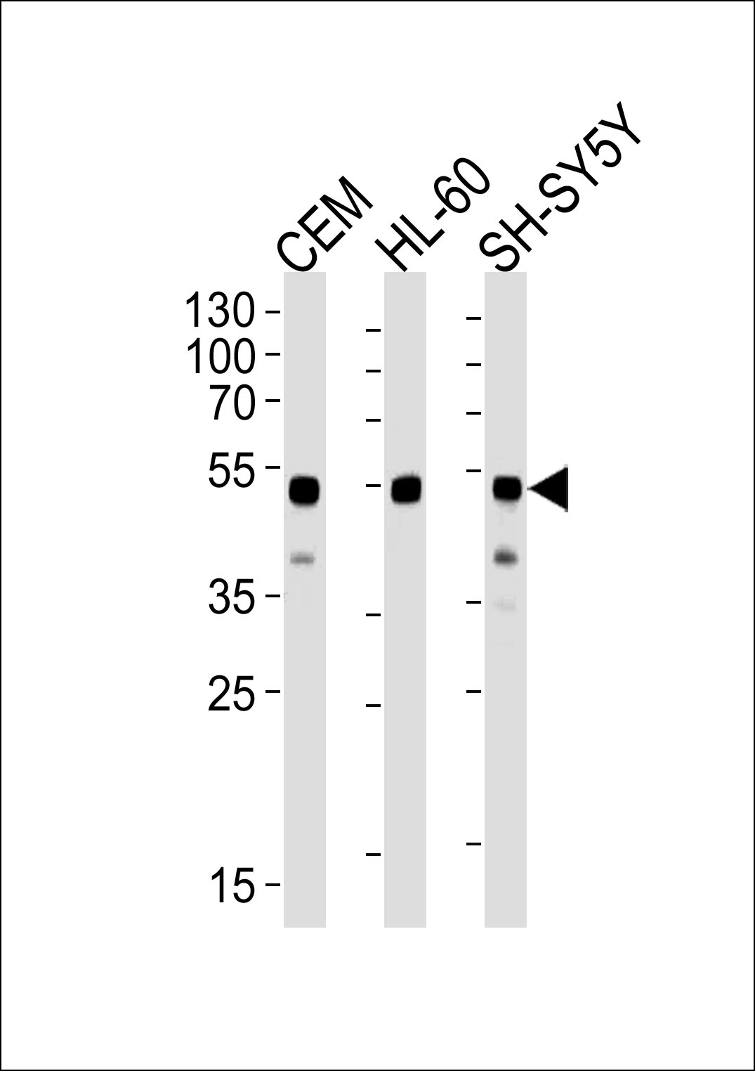 Mouse anti-GATA3 Monoclonal Antibody(Center)(1259CT707.136.102)