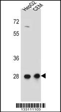 Rabbit anti-CCDC134 Polyclonal Antibody(C-term)