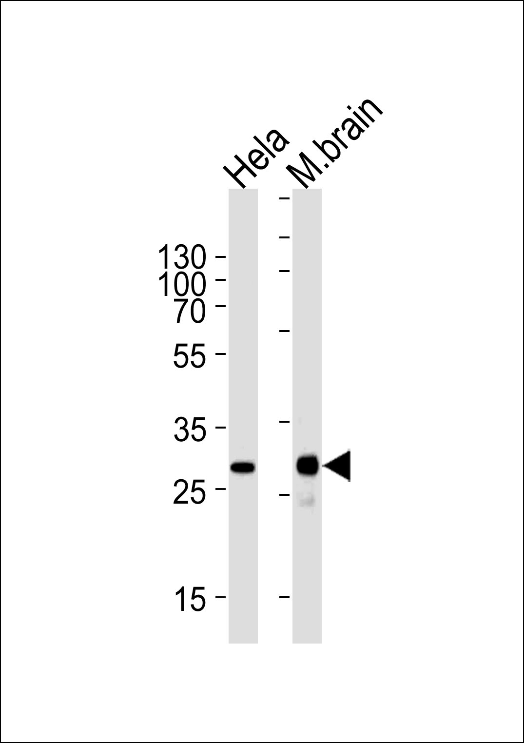 Mouse anti-CDK5 Monoclonal Antibody(1321CT281.130.129)