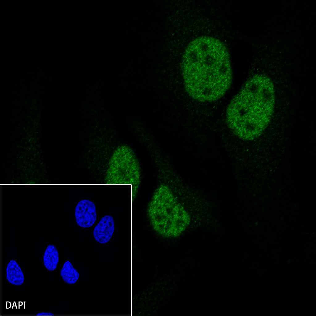 Rabbit anti-MLH1 Recombinant Monoclonal Antibody(112-50)