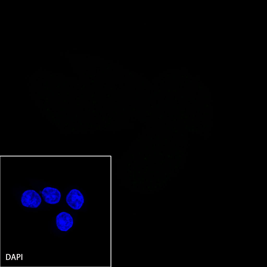 Rabbit anti-MLH1 Recombinant Monoclonal Antibody(112-50)