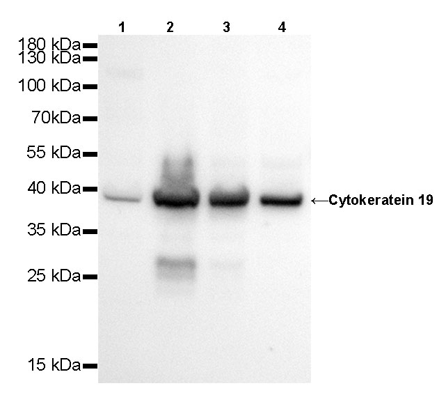 Rabbit anti-CytokeRatin 19 Recombiant Monoclonal Antibody(107-19)