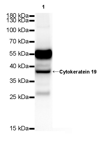 Rabbit anti-CytokeRatin 19 Recombiant Monoclonal Antibody(107-19)