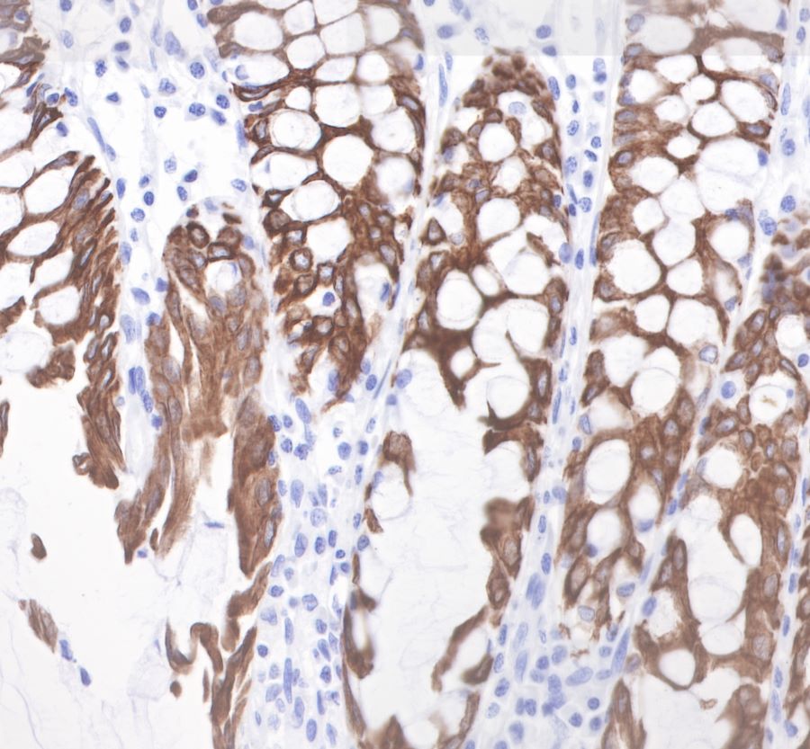 Rabbit anti-CytokeRatin 19 Recombiant Monoclonal Antibody(107-19)