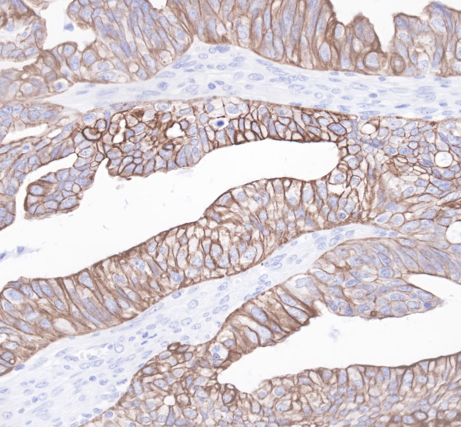 Rabbit anti-CytokeRatin 19 Recombiant Monoclonal Antibody(107-19)