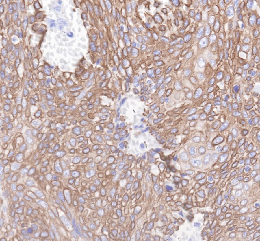 Rabbit anti-CytokeRatin 19 Recombiant Monoclonal Antibody(107-19)