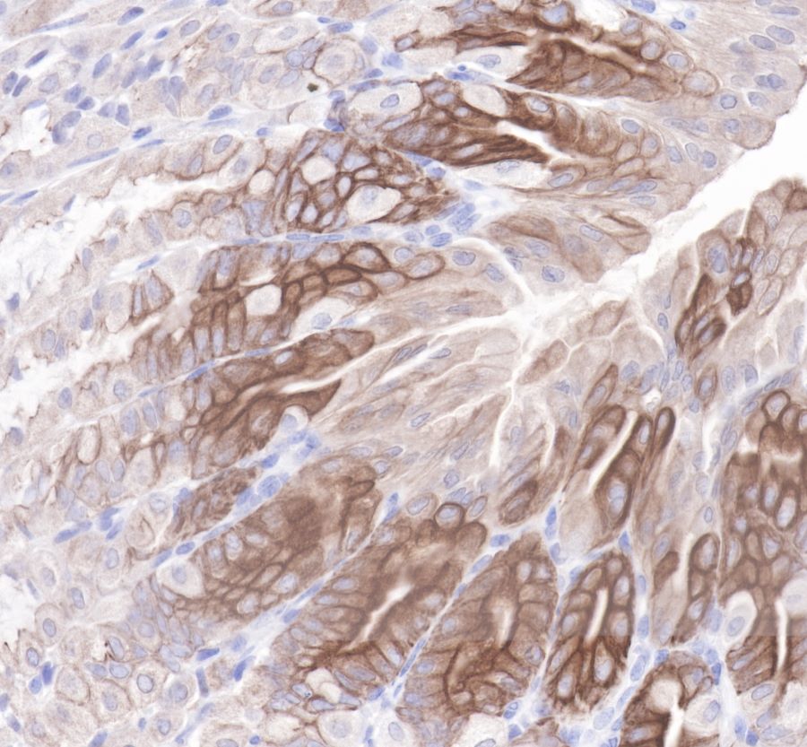 Rabbit anti-CytokeRatin 19 Recombiant Monoclonal Antibody(107-19)