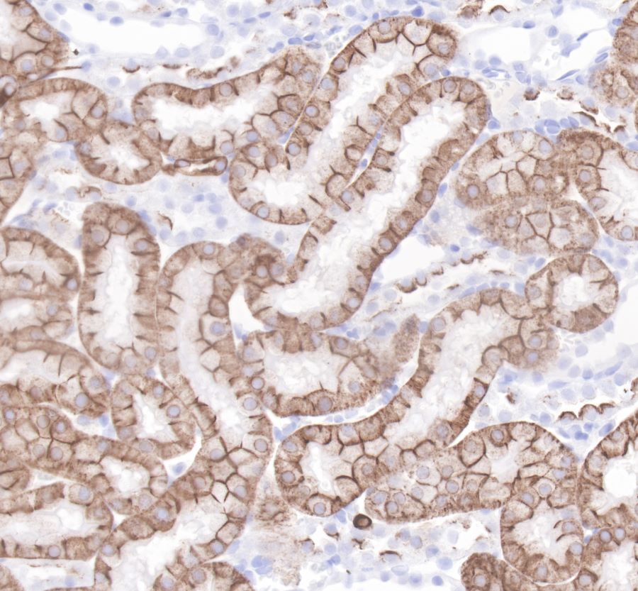 Rabbit anti-CytokeRatin 19 Recombiant Monoclonal Antibody(107-19)