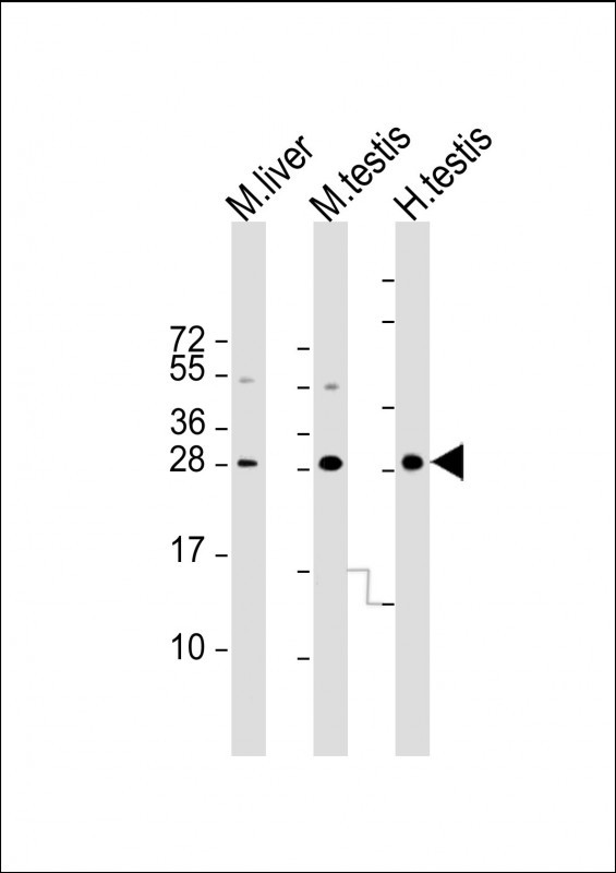 Mouse anti-CDX1 Monoclonal Antibody(C-term)(937CT11.6.2)