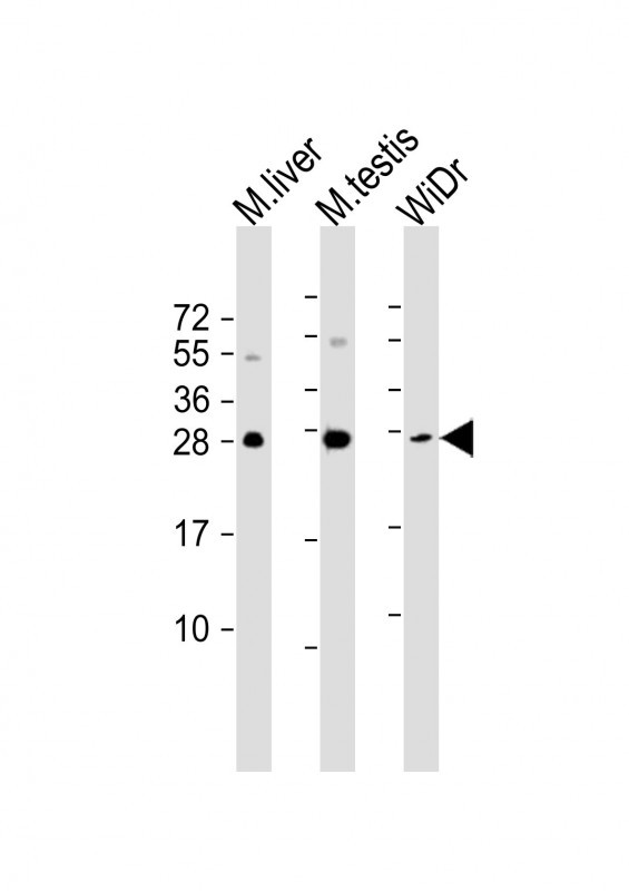 Mouse anti-CDX1 Monoclonal Antibody(C-term)(937CT11.6.2)