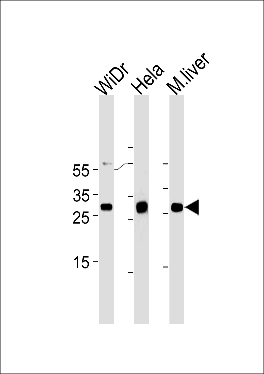 Mouse anti-CDX1 Monoclonal Antibody(C-term)(937CT11.6.2)