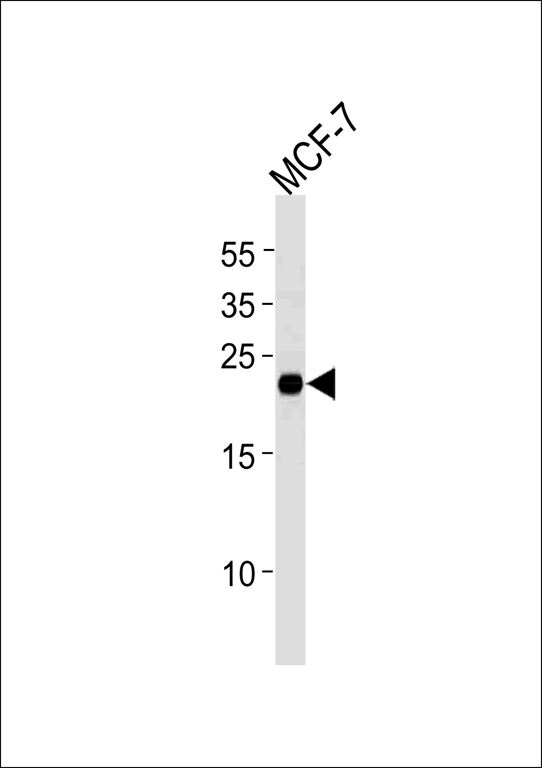 Mouse anti-MGMT Monoclonal Antibody(888CT22.2.4)