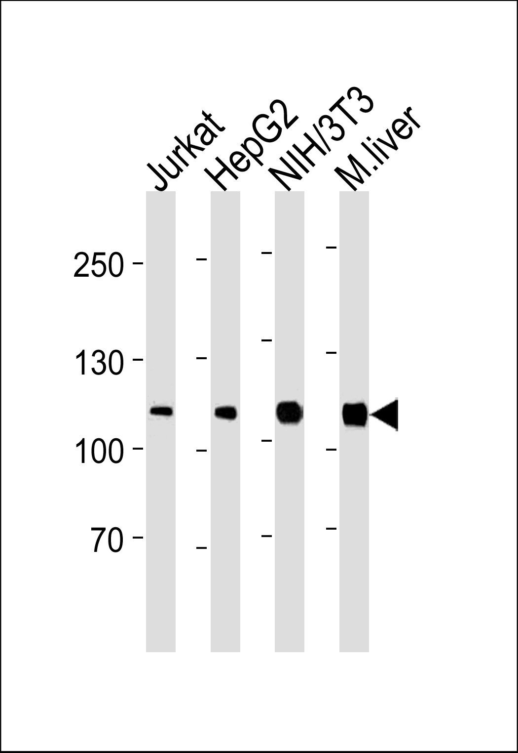 Mouse anti-NR3C1 Monoclonal Antibody(740CT12.1.5)