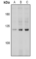 Rabbit anti-CD144(pY731) Polyclonal Antibody