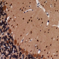 Rabbit anti-CD144(pY731) Polyclonal Antibody