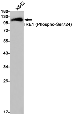 Rabbit anti-Phospho-IRE1(Ser724) Monoclonal Antibody(3I5)