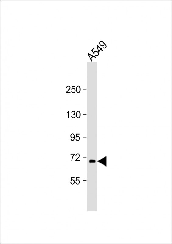 Rabbit anti-RNF43 Polyclonal Antibody(C-term)