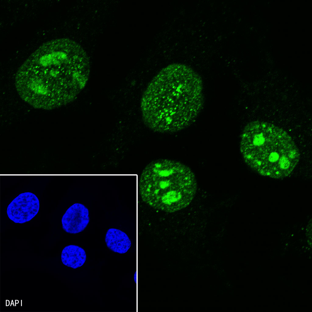 Mouse anti-Ki67 Monoclonal Antibody(606-33)