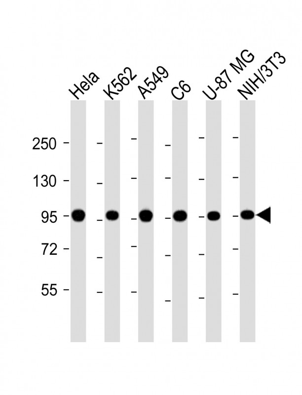 Mouse anti-TERA Monoclonal Antibody(1563CT163.48.77)