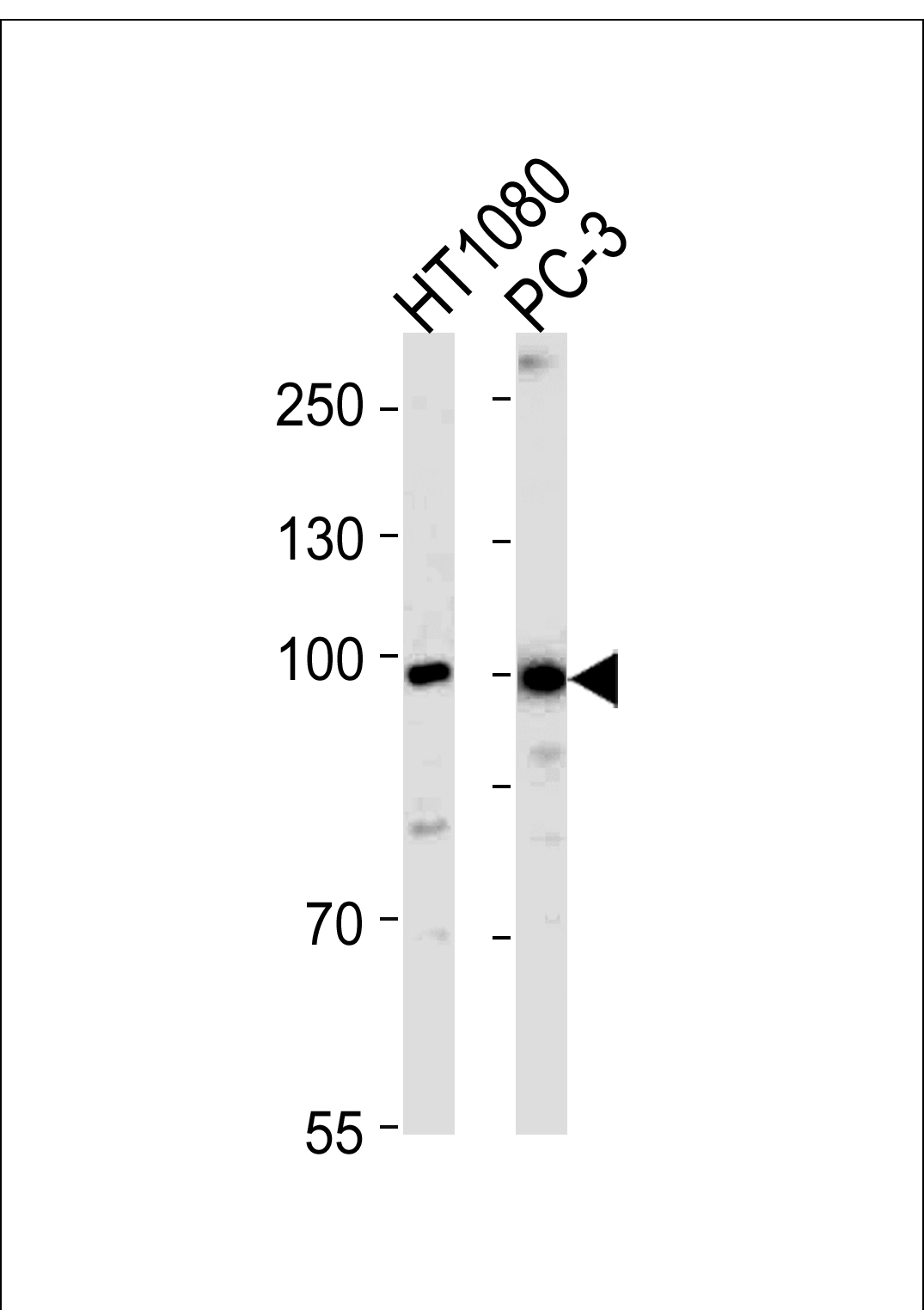 Rabbit anti-ZNF560 Polyclonal Antibody(Center)